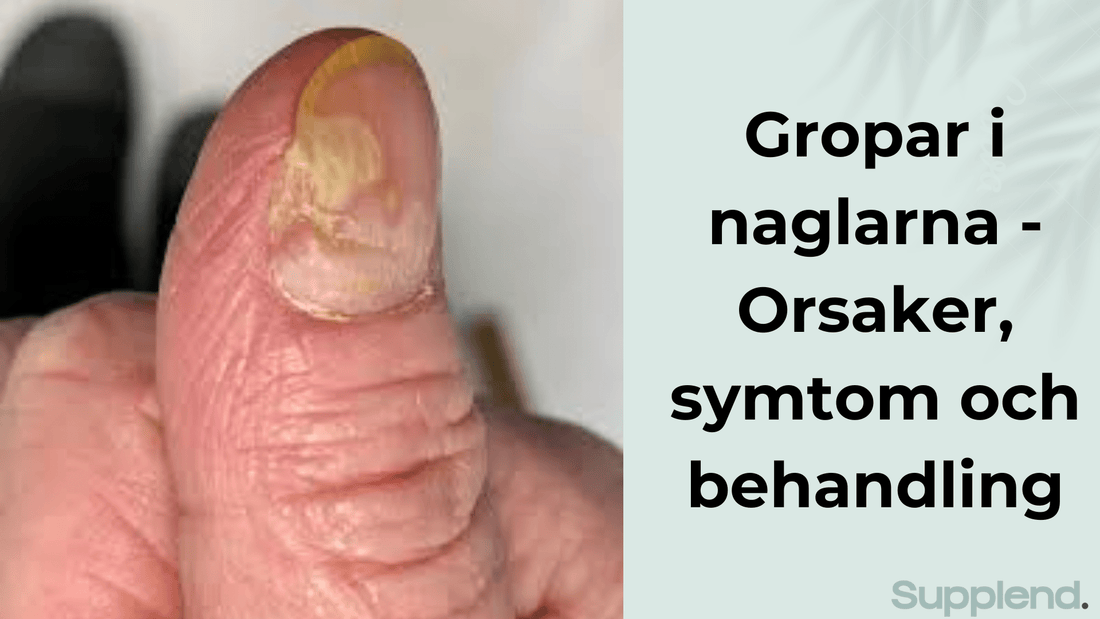 Gropar i naglarna - Orsaker, symtom och behandling