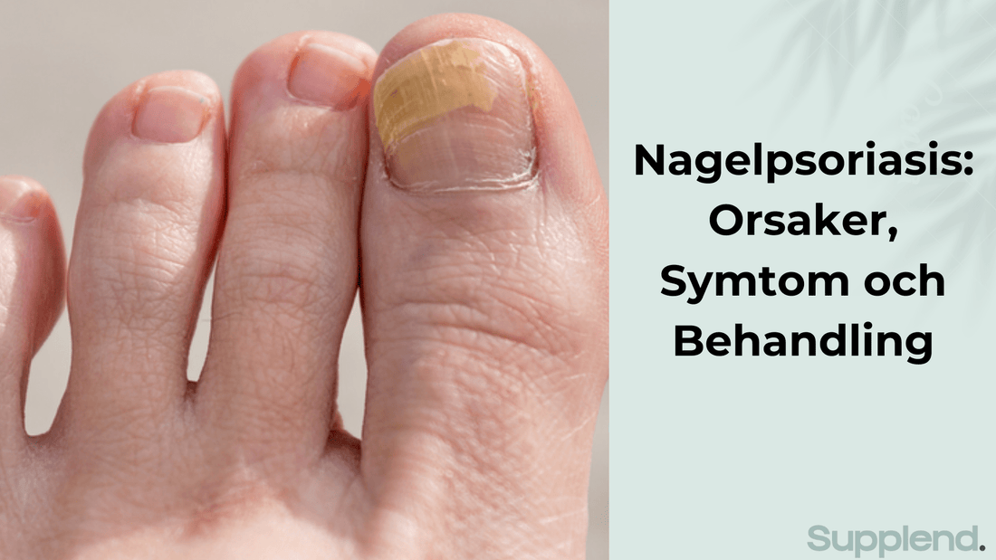 Nagelpsoriasis: Orsaker, Symtom och Behandling