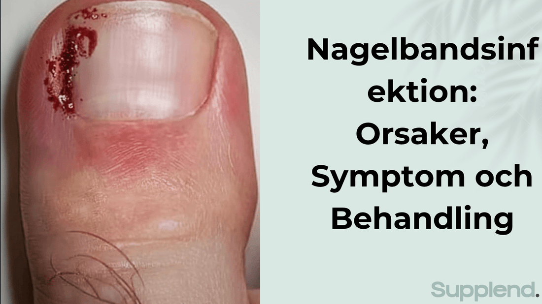 Nagelbandsinfektion: Orsaker, Symptom och Behandling