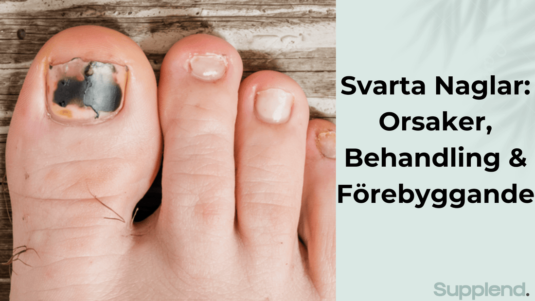 Svarta Naglar: Orsaker, Behandling & Förebyggande